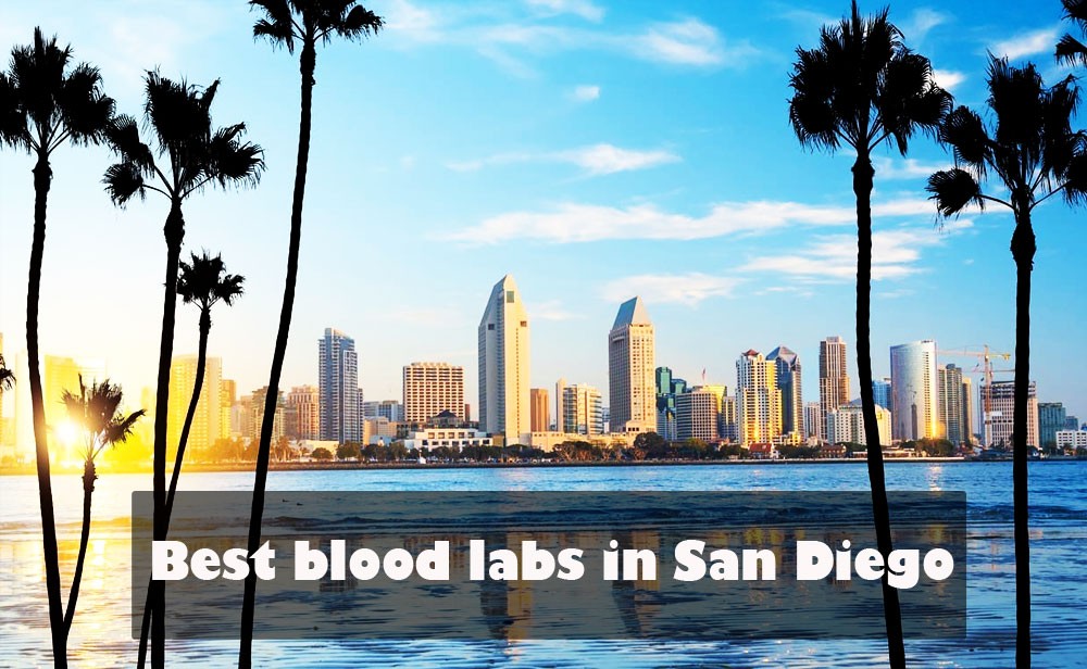 Best blood labs in San Diego