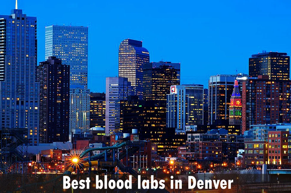 Best blood labs in Denver