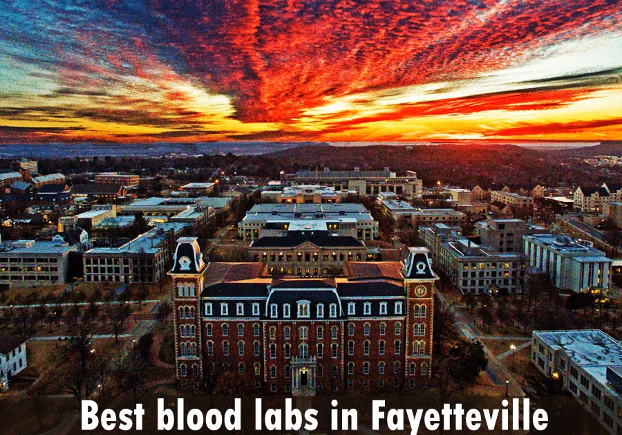Best blood labs in Fayetteville