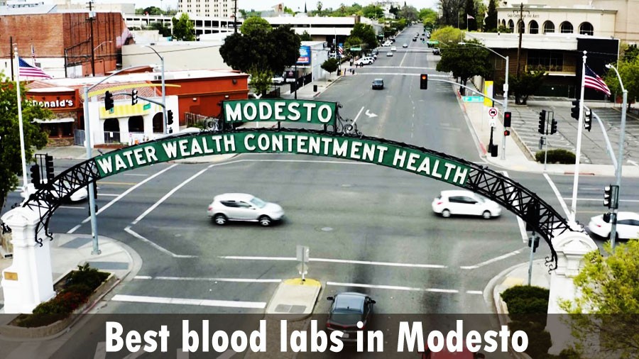 Best blood labs in Modesto