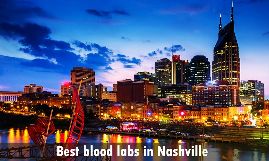 Best blood labs in Nashville