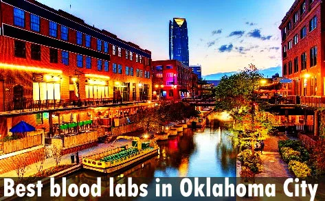 Best blood labs in Oklahoma City