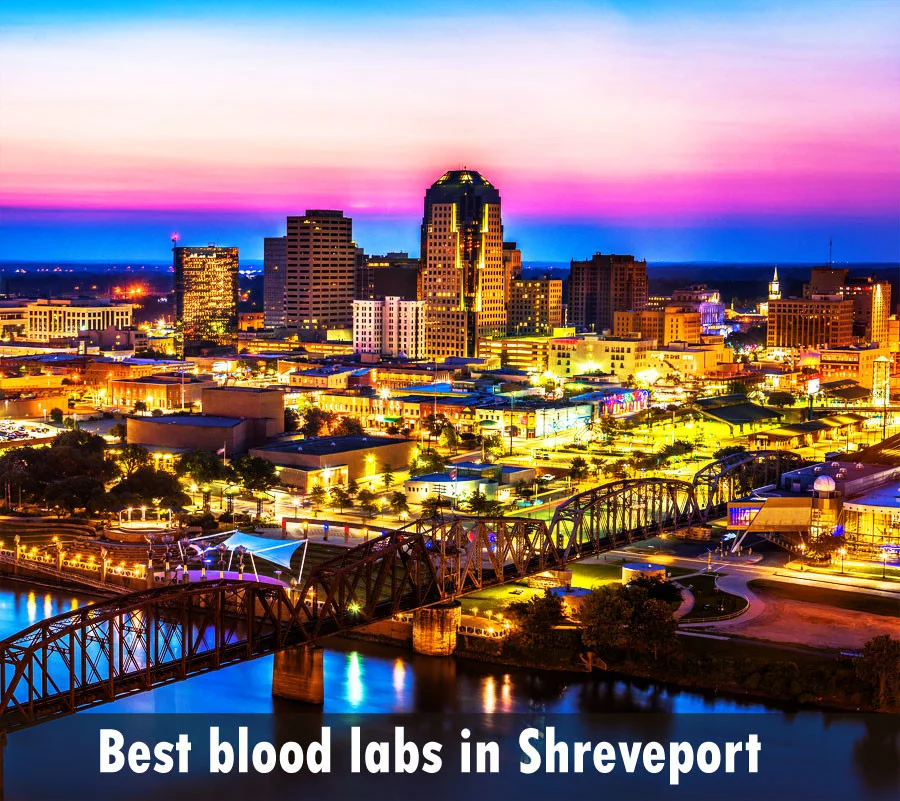 Best blood labs in Shreveport