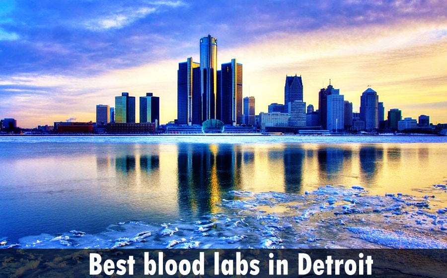 best blood labs in Detroit