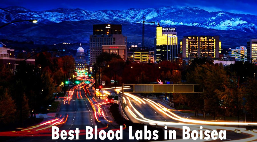 Best Blood Labs in Boise