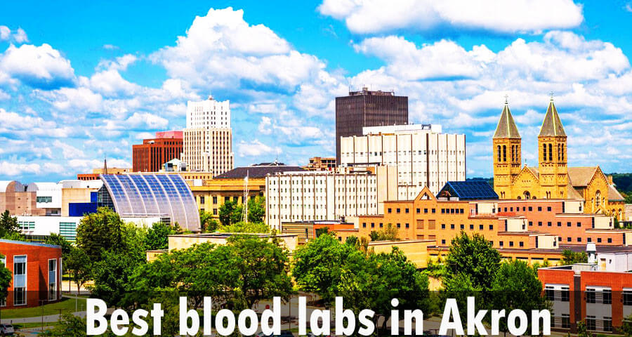 Best blood labs in Akron