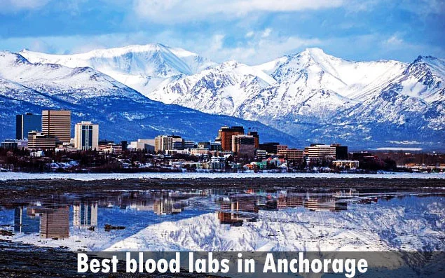 Best blood labs in Anchorage