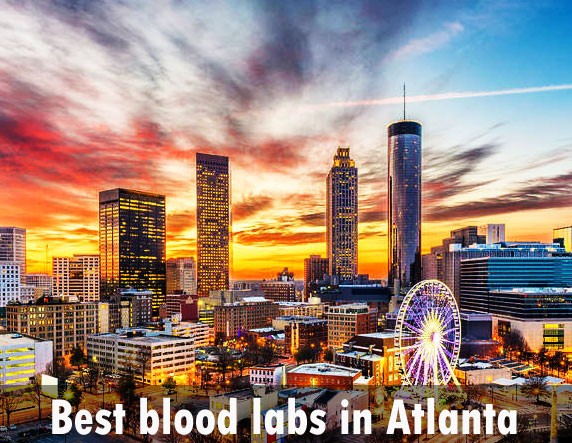 Best blood labs in Atlanta