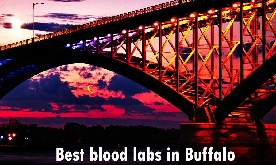 What is the list of best blood labs in Buffalo?
