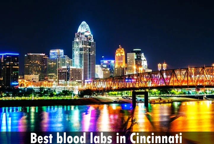 Best blood labs in Cincinnati