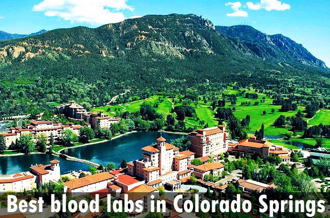 Best blood labs in Colorado Springs