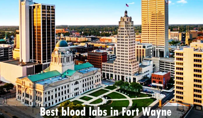 Best blood labs in Fort Wayne