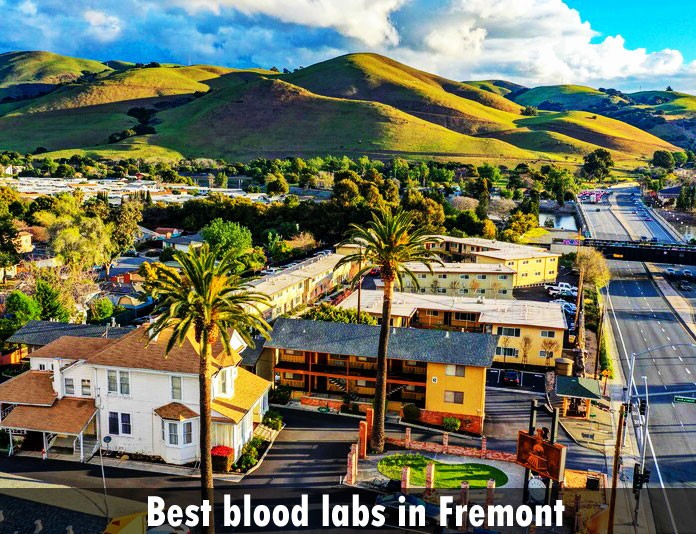 Best blood labs in Fremont