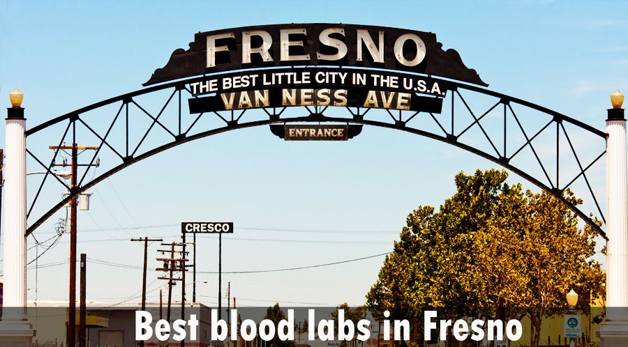 Best blood labs in Fresno