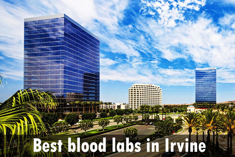 Best blood labs in Irvine
