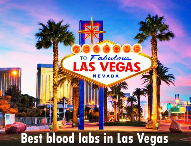 Best blood labs in Las Vegas