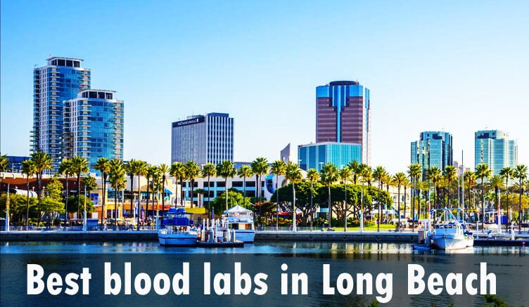 Best blood labs in Long Beach