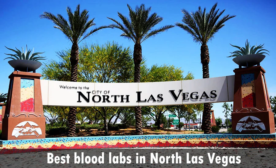 Best blood labs in North Las Vegas