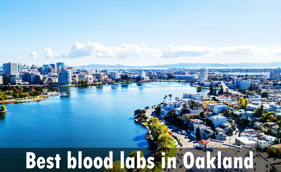 Best blood labs in Oakland