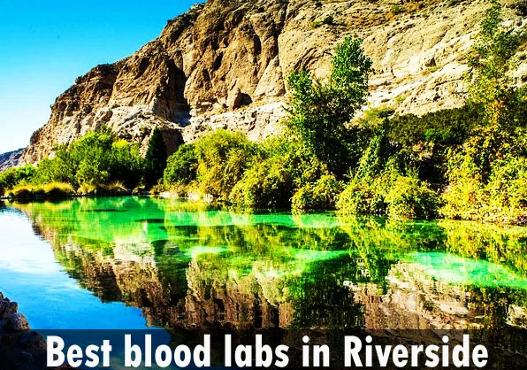 Best blood labs in Riverside