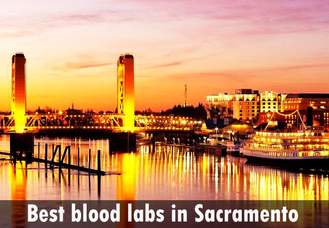 Best blood labs in Sacramento