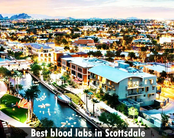 Best blood labs in Scottsdale