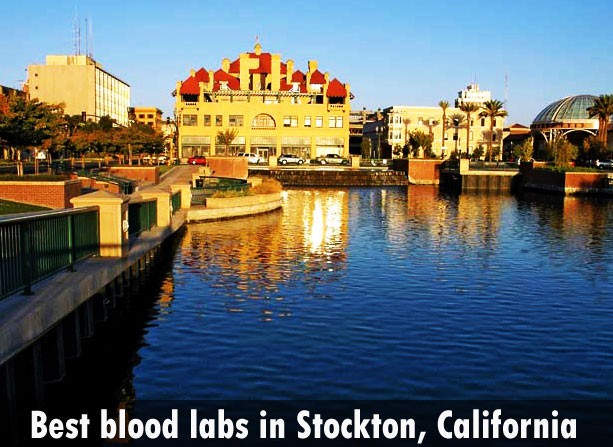 Best blood labs in Stockton, California