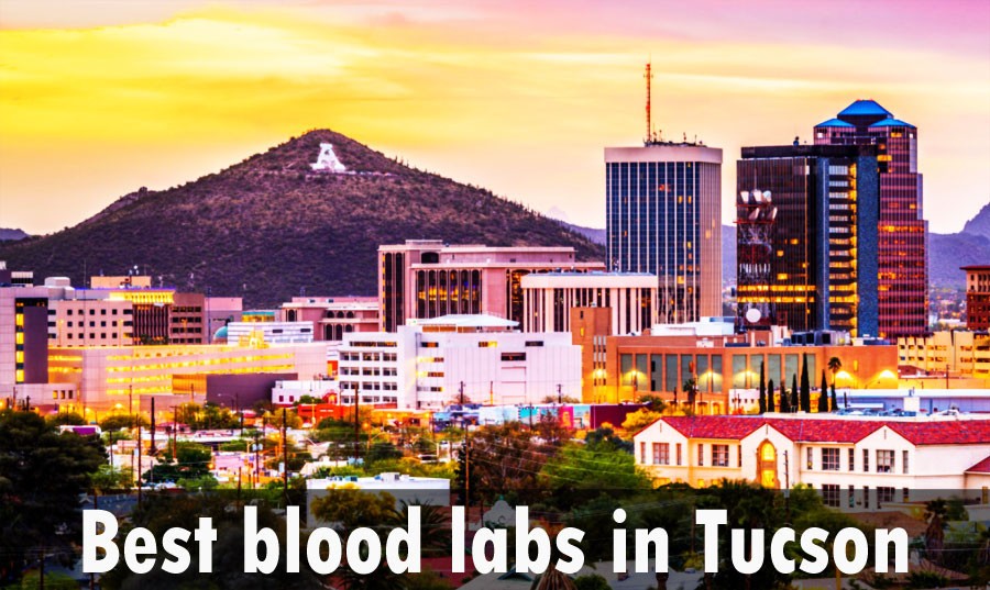 Best blood labs in Tucson