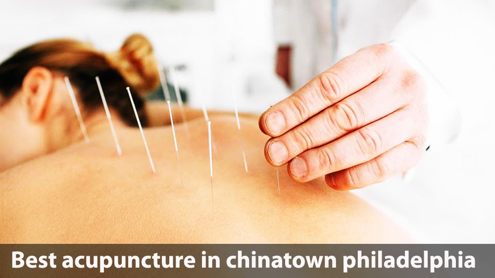 Best acupuncture in Chinatown Philadelphia