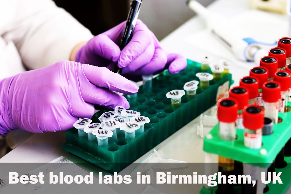 Best blood labs in Birmingham, UK