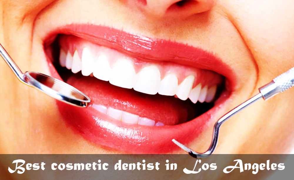 Best cosmetic dentists in Los Angeles