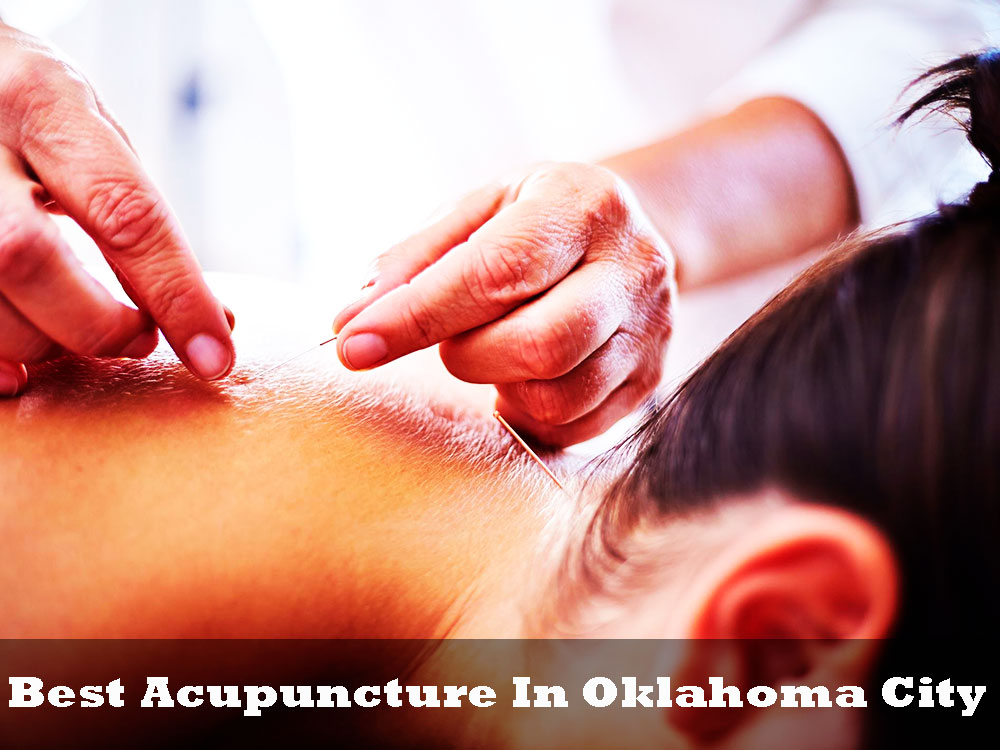 Best Acupuncture In Oklahoma City