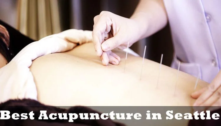 Best Acupuncture in Seattle
