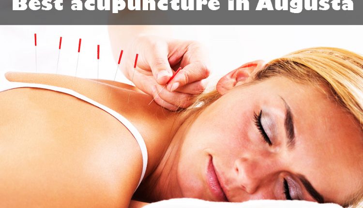 Best acupuncture in Augusta