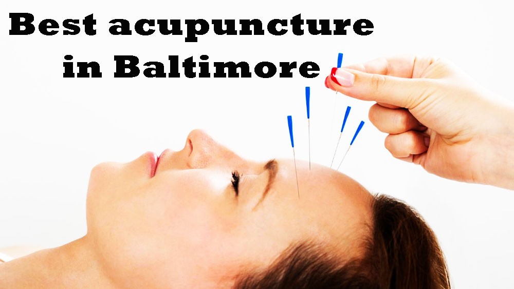 Best acupuncture in Baltimore