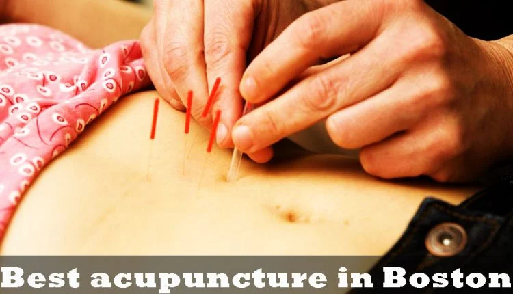 Best acupuncture in Boston