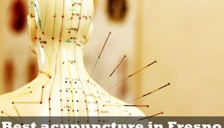 Best acupuncture in Fresno