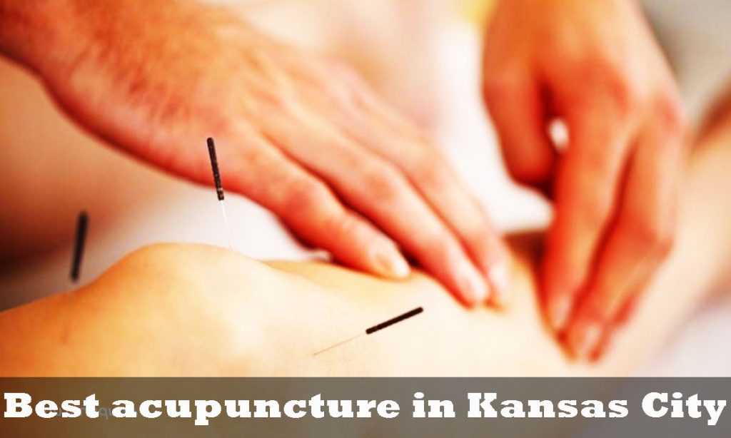 12 Best Acupuncture In Kansas City {Phone Number & Address}