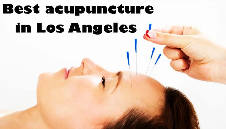 Best acupuncture in Los Angeles