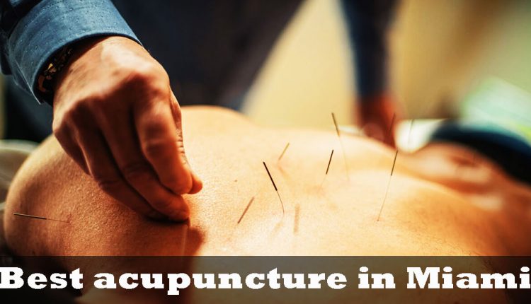 Best acupuncture in Miami