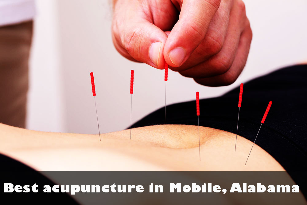 Best acupuncture in Mobile, Alabama