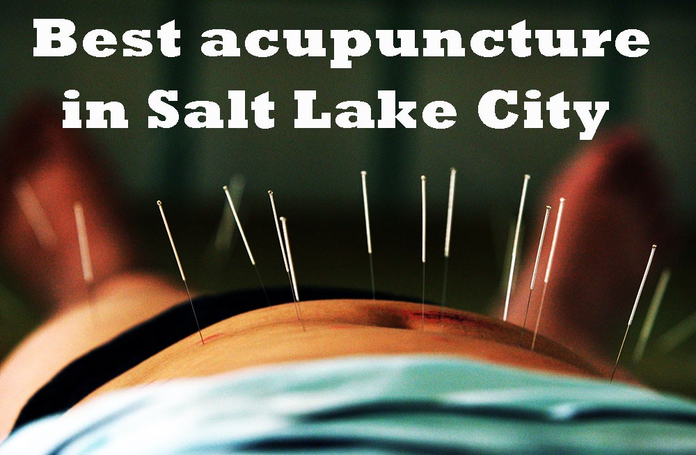 Best acupuncture in Salt Lake City