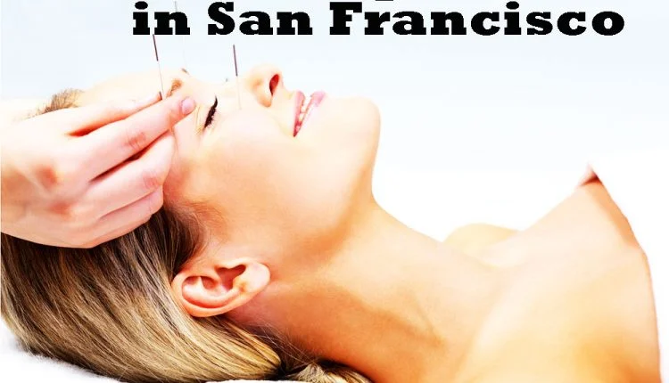 Best acupuncture in San Francisco