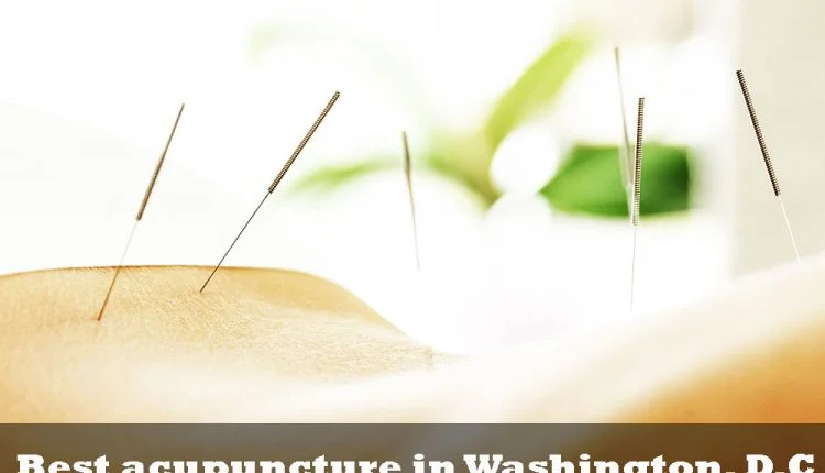 Best acupuncture in Washington, D.C.