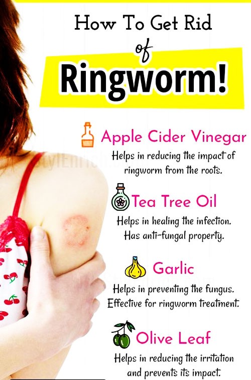 Best Ways to Clear Nail Polish Ringworm [in 4 weeks]