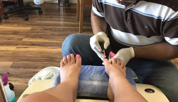 Embarrassed to get a pedicure