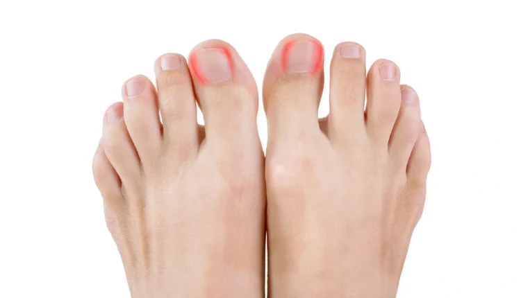 Who does cut the sides of toenails in nail salons?